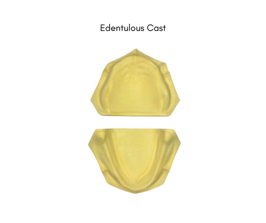 Edentulous Cast